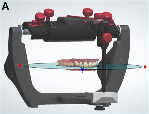 semiadjustable articulator